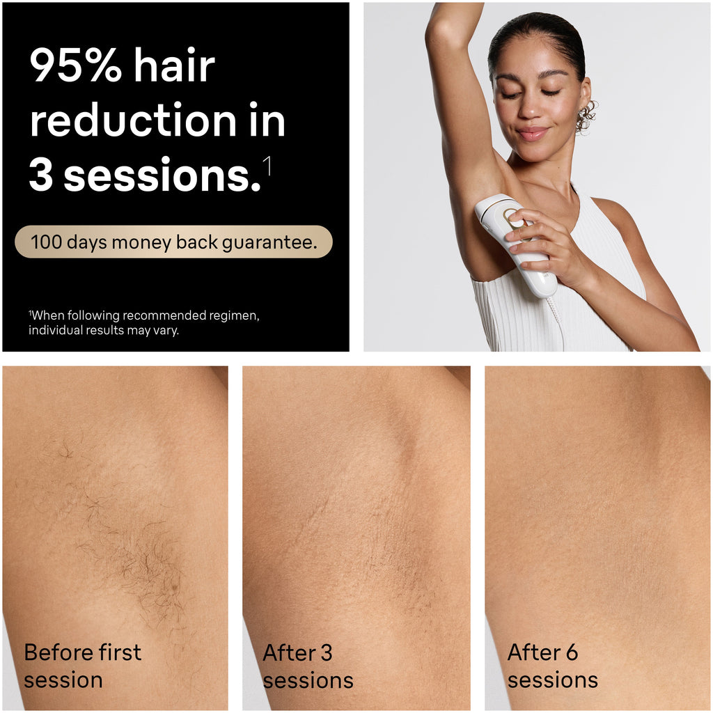 Braun Smart IPL Silk·Expert Pro 5: At Home Alternative to Laser Hair Removal with 4 Caps Facial Hair Trimmer and Vanity Case IPL5442